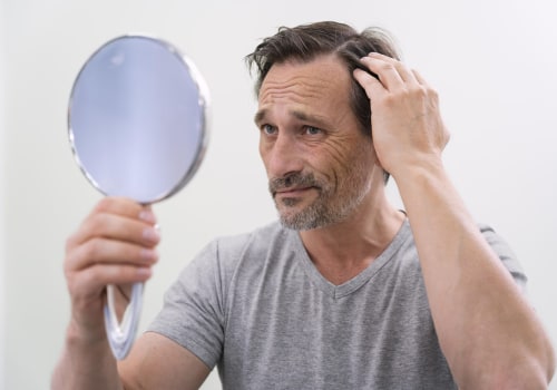Understanding Hair Loss: Causes, Treatments, and Prevention